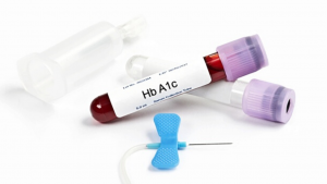 HbA1C